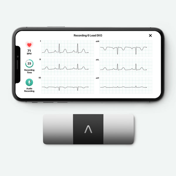 Sinus Rhythm Apple Watch Kardia KardiaMobile 6L Lead ECG AliveCor UK